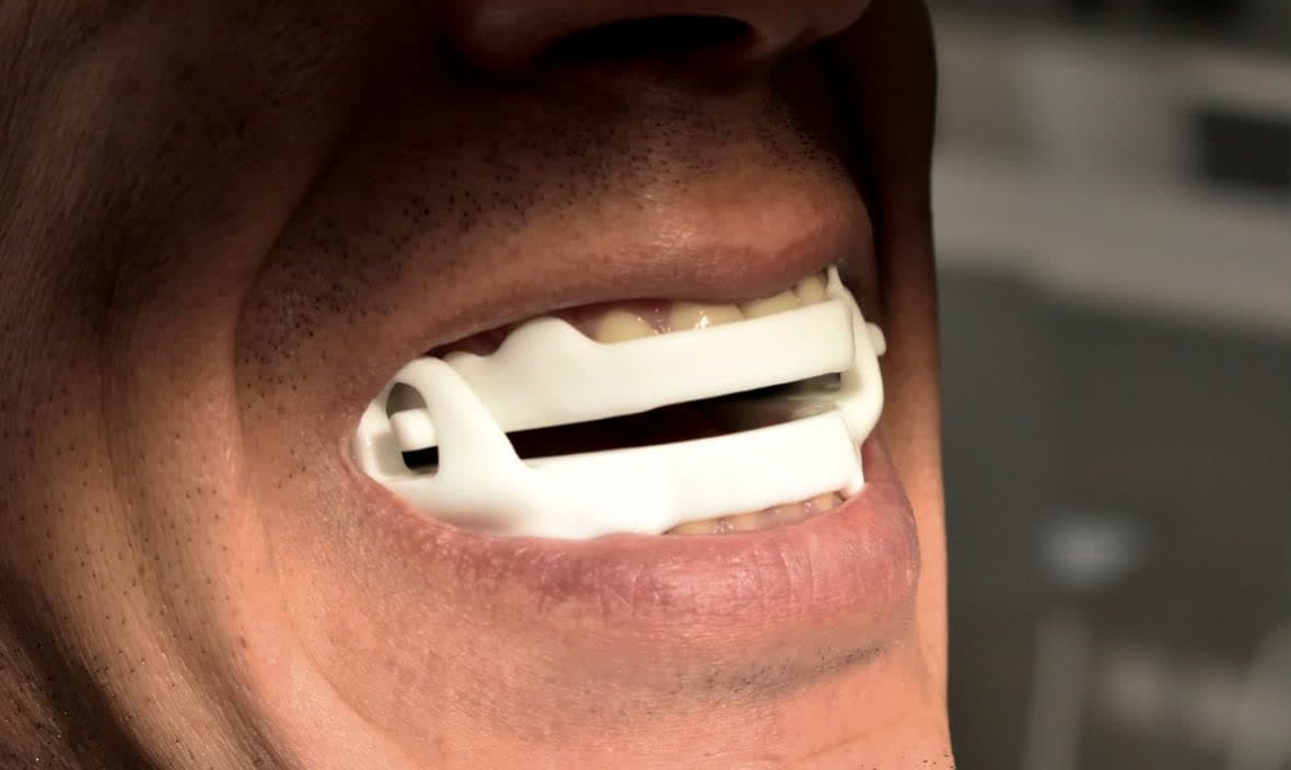 Paciente utilizando un dispositivo de avance mandibular